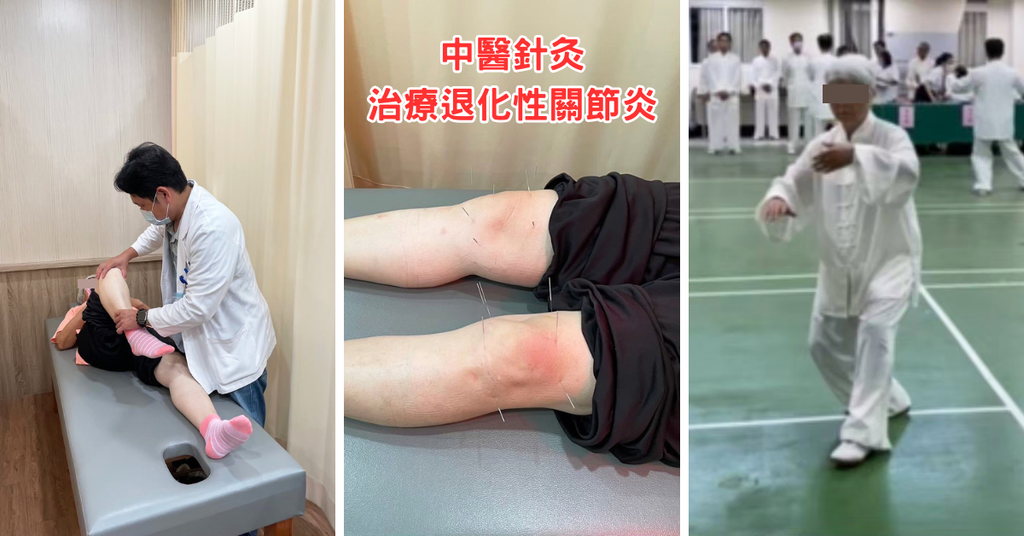 台南中醫針灸推薦：寳文中醫診所，阿嬤的退化性關節炎好很多！日
