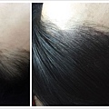 NPM紋髮專家紋髮際線紋髮紋頭皮