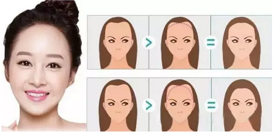 究竟紋髮有咩造型?咁究竟紋髮又可唔可以咁多揀擇呢？