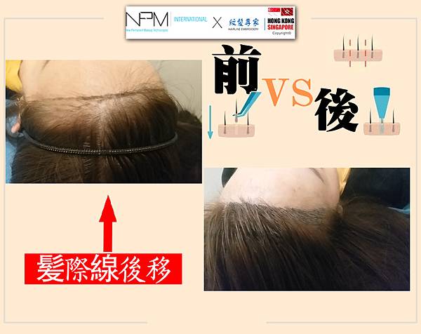 紋髮解決髮量少問題