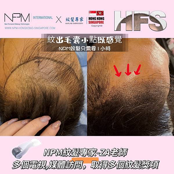 【NPM紋髮專家】ZA老師 -- NPM紋髮性價比高 【NPM紋髮專家】ZA老師 -- NPM紋髮性價比高
