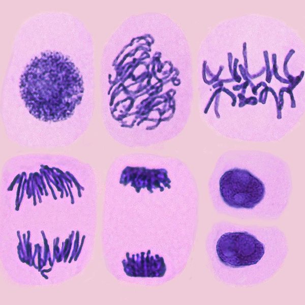 (https://fineartamerica.com/featured/3-plant-cell-mitosis-steve-gschmeissner.html?product=poster)