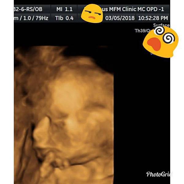 28783744_187001818573258_9199888579243535637_n.jpg 28783744_187001818573258_9199888579243535637_n.jpg