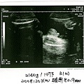 婦幼-產檢記事之藍寶超音波20081203-2.jpg