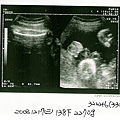 婦幼-產檢記事之藍寶超音波20081217-2.jpg
