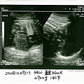 婦幼-產檢記事之藍寶超音波20081229.jpg