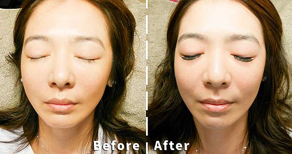 BF 2.jpg 施作之前與之後對照圖