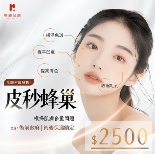 鳳凰電波（Thermage FLX）是什麼?為什麼醫美診所都