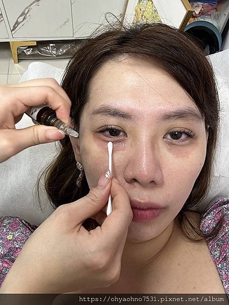 [蘆洲區] easy beauty 黑眼圈半永久遮瑕 向熊貓