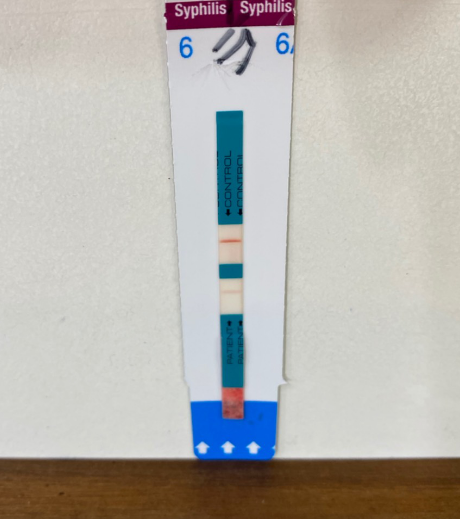 又一位驗出梅毒陽性反應 梅毒檢驗空窗期與梅毒傳染方式宣導 民生醫事檢驗所x光檢查 感染愛滋 過敏原檢測 勞工身體體檢 健康檢查諮詢網