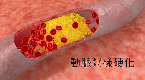 「保護你的心臟：定期健康檢查，掌握膽固醇的動態變化」