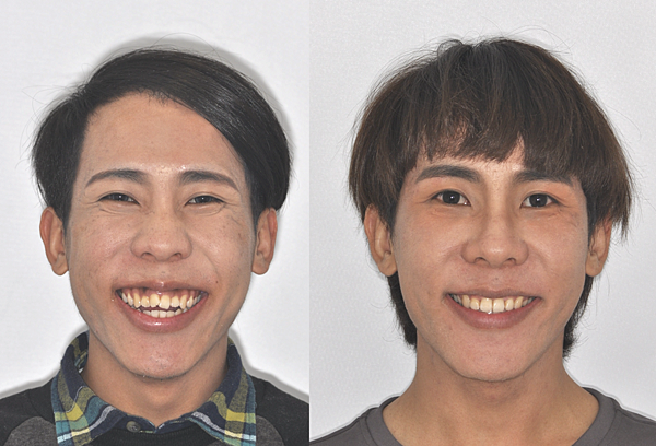 截圖 2022-07-14 上午3.34.35