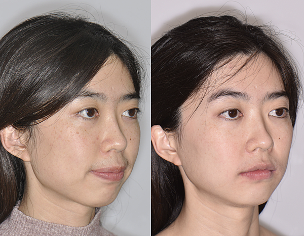 截圖 2023-01-19 下午5.57.53