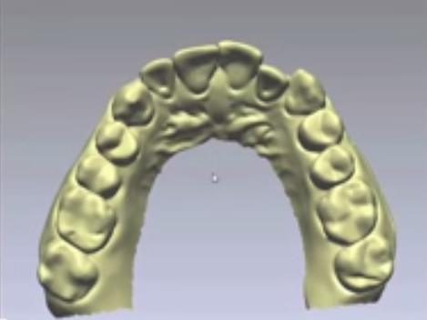 宜可麗矯正軟體