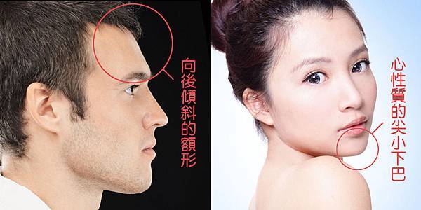 額頭後傾與心性質下巴