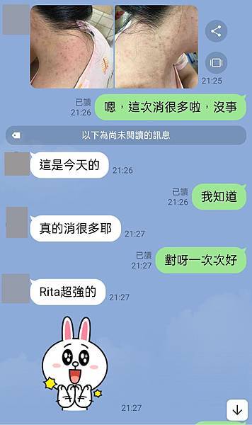 台北專業臉部保養、肩膀脖子長痘痘栗粒腫