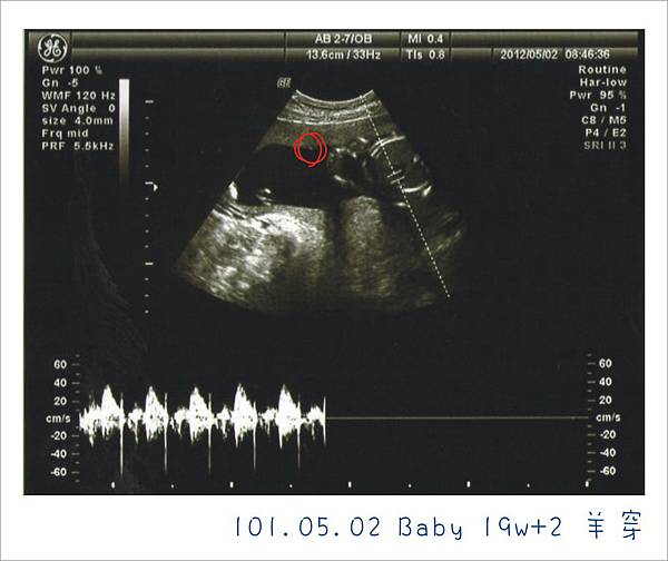 101.05.02  Baby 19w+2 羊穿