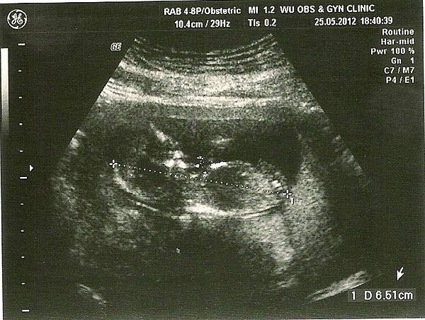 20120525-01-第二次產檢
