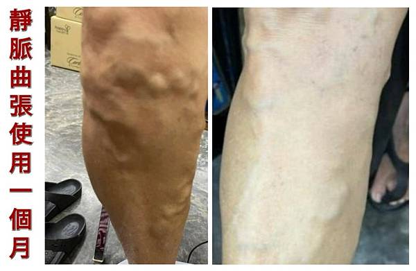 Olylife 足墊熱儀P90使用見證