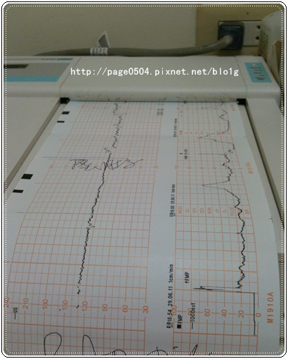 兔年報喜 38w 水腫 胎心音 宮縮監測 張仔仔還是張欣仔咧 O 痞客邦