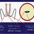 婦科採集子抹技巧