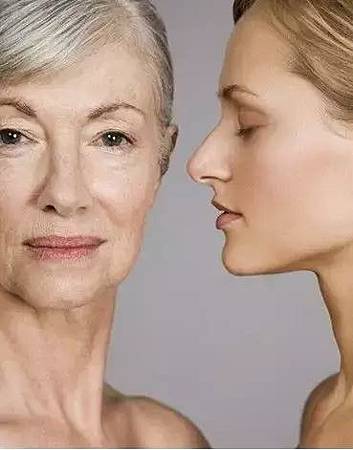 鬆弛源於自然老化，可以見到下眼部、臉皮、頸部的鬆弛。.jpg