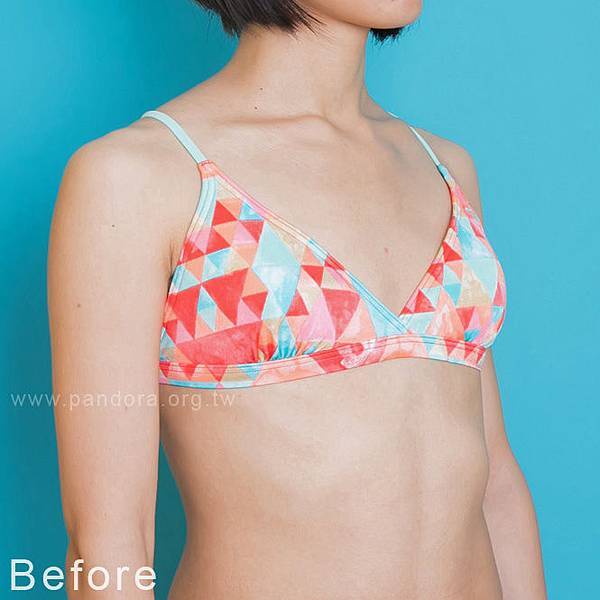 隆乳價位 Motiva魔滴隆乳