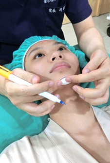 台中卡麥拉墊下巴推薦 台中卡麥拉墊下巴推薦