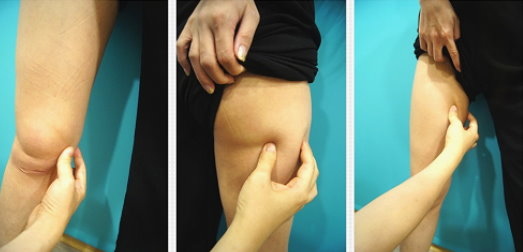 台中自體脂肪 台中自體脂肪