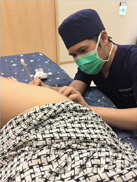 台中自體脂肪 豐胸 台中自體脂肪 豐胸