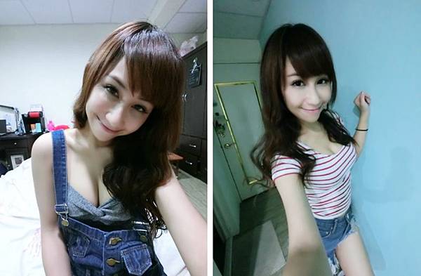 台中自體脂肪 豐胸 台中自體脂肪 豐胸