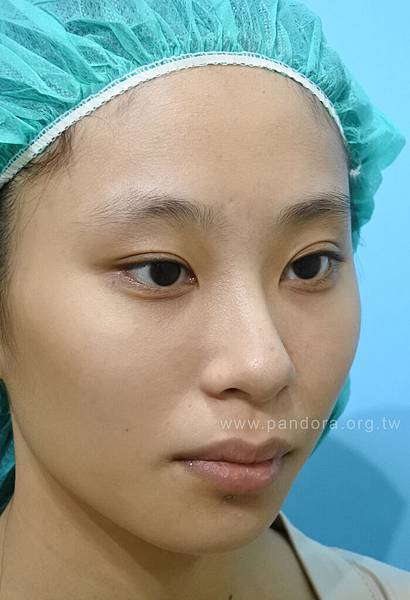 台中卡麥拉墊下巴推薦 台中卡麥拉墊下巴推薦