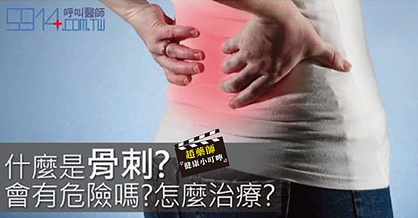 什麼是骨刺?會有危險嗎?怎麼治療?-01 什麼是骨刺?會有危險嗎?怎麼治療?-01