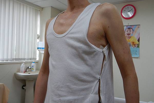 病友設計的方便內衣