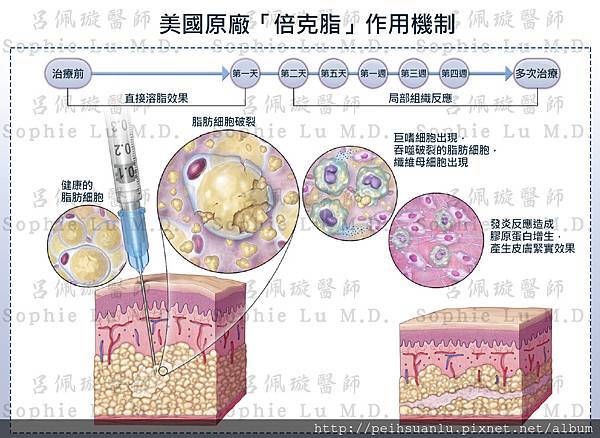 Belkyra美國原廠「倍克脂」作用機制