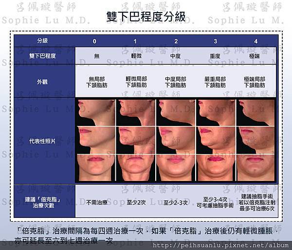 Belkyra倍克脂雙下巴程度分級 Belkyra倍克脂雙下巴程度分級