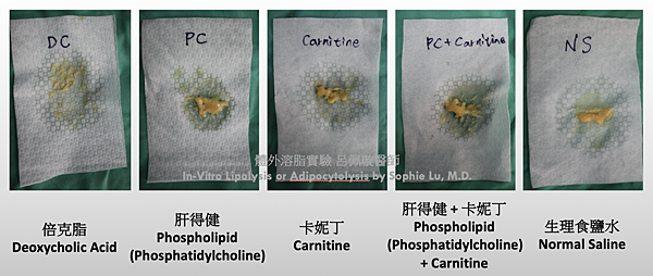 呂佩璇醫師 美國 vs. 台灣消脂針 體外溶脂實驗.png