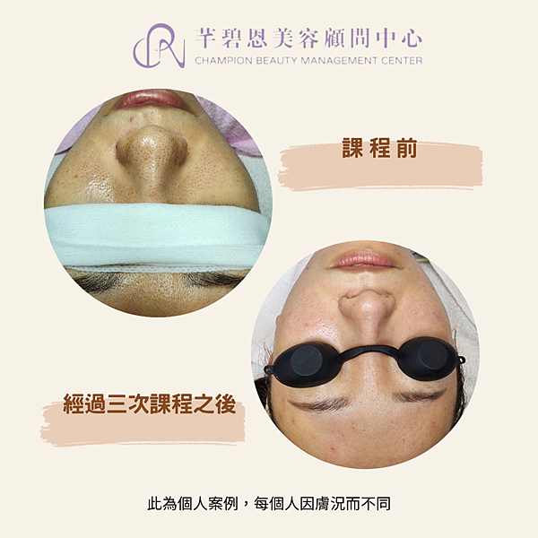 圖3png.png 圖3png.png