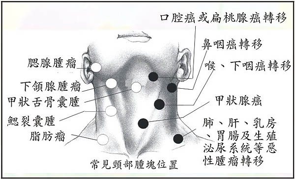 p06