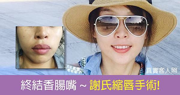 縮唇廣告6 縮唇廣告6
