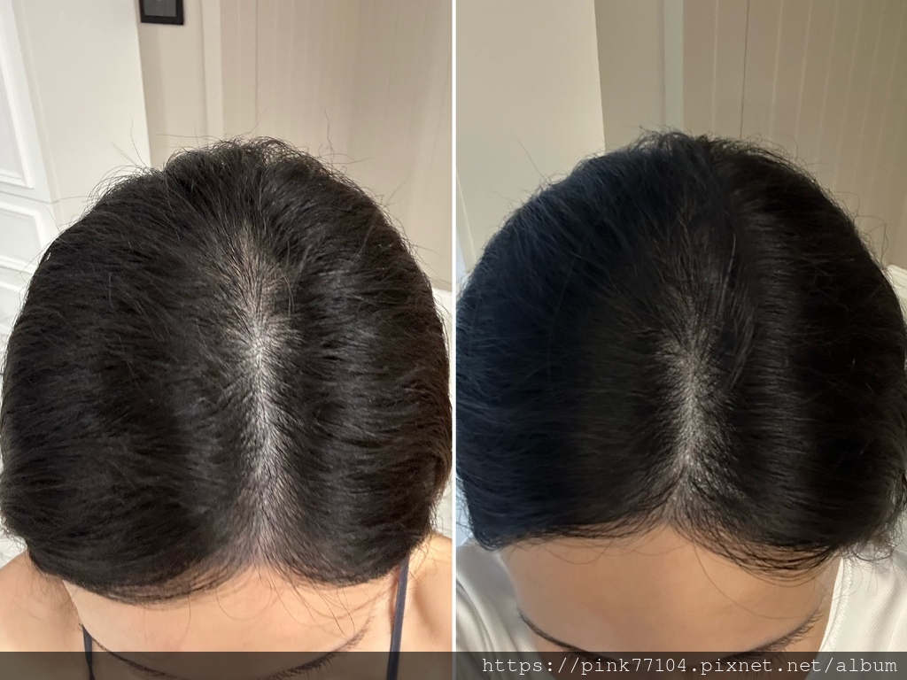 <保養>外泌體的力量～從頭皮健康開始的美髮之路-泌TＯ外泌體