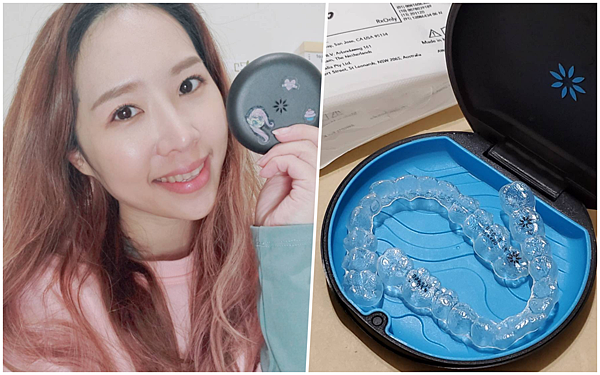 【愛美】牙齒決定臉型?我的隱適美隱形牙套日記 【愛美】牙齒決定臉型?我的隱適美隱形牙套日記