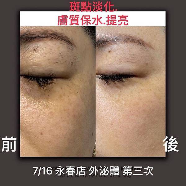 【體驗分享】外泌體臉部保養初體驗——透亮肌膚一次見效！