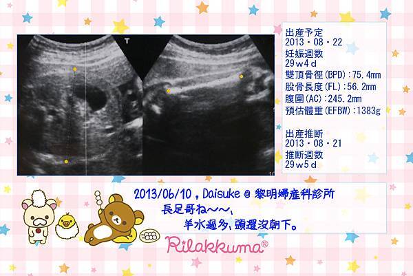 Daisuke_UltraSound_20130610.jpg