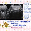 Daisuke_UltraSound_20130610.jpg