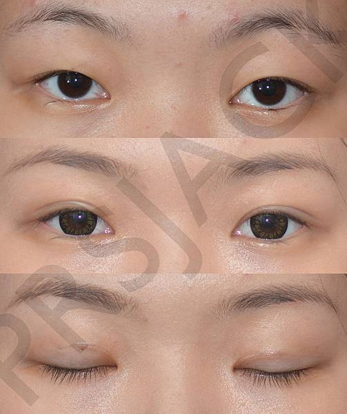 CASE11.jpg CASE11.jpg