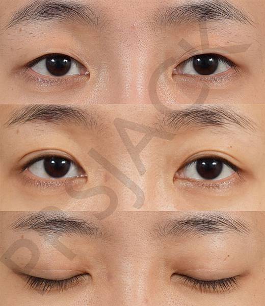 CASE06.jpg CASE06.jpg