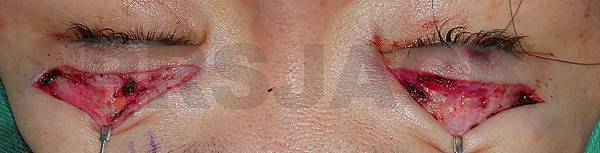 P1100025.JPG P1100025.JPG