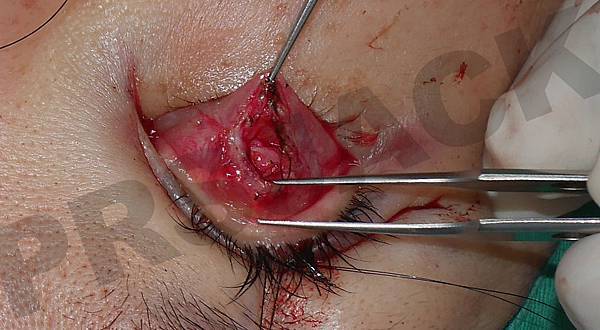 P1100029.JPG P1100029.JPG