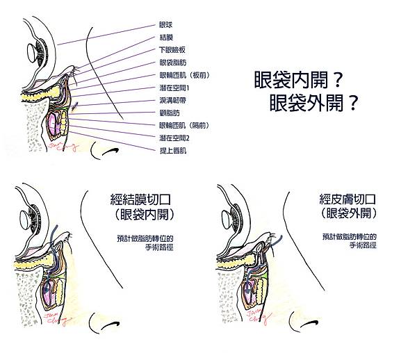 內開外開.jpg 內開外開.jpg